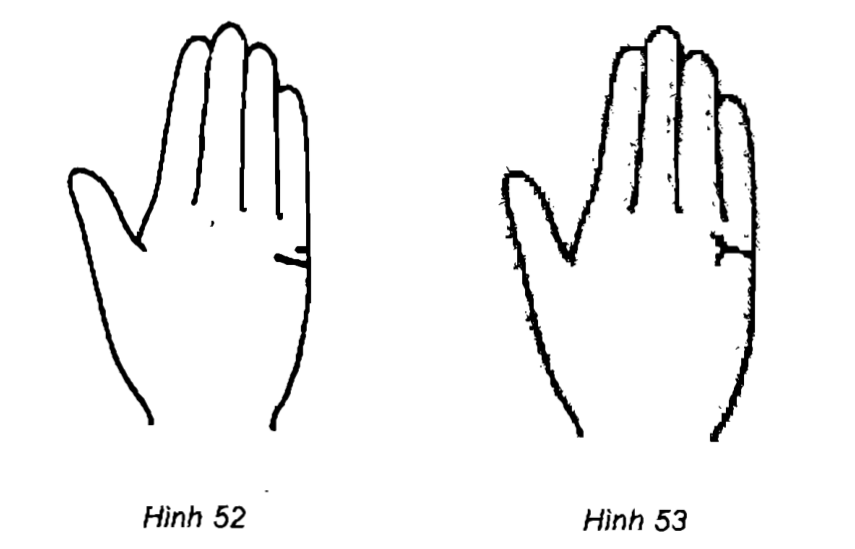 Minh họa các dạng đường để so sánh hình dạng và vị trí.